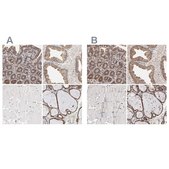 Anti-PDIA3 antibody produced in rabbit Ab2, Prestige Antibodies® Powered by Atlas Antibodies, affinity isolated antibody, buffered aqueous glycerol solution