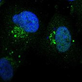 Anti-ZNF75D antibody produced in rabbit Prestige Antibodies® Powered by Atlas Antibodies, affinity isolated antibody, buffered aqueous glycerol solution
