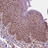 Anti-PSMC5 antibody produced in rabbit Prestige Antibodies® Powered by Atlas Antibodies, affinity isolated antibody