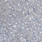Anti-ARID5B antibody produced in rabbit Prestige Antibodies® Powered by Atlas Antibodies, affinity isolated antibody, buffered aqueous glycerol solution