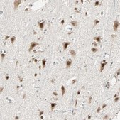 Anti-PRDM2 antibody produced in rabbit Prestige Antibodies® Powered by Atlas Antibodies, affinity isolated antibody, buffered aqueous glycerol solution