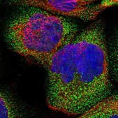 Anti-CROT antibody produced in rabbit Prestige Antibodies® Powered by Atlas Antibodies, affinity isolated antibody, buffered aqueous glycerol solution, Ab3