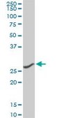 Monoclonal Anti-CNOT7 antibody produced in mouse clone 2F6, purified immunoglobulin, buffered aqueous solution