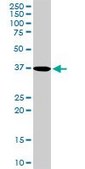 Anti-PDLIM1 antibody produced in rabbit purified immunoglobulin, buffered aqueous solution