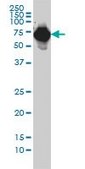 Monoclonal Anti-AFP antibody produced in mouse clone 1G7, purified immunoglobulin, buffered aqueous solution