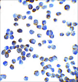 Anti-ZEB1 antibody produced in rabbit affinity isolated antibody, buffered aqueous solution