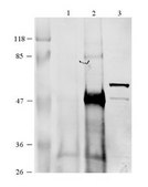Anti-CCT6B antibody produced in rabbit affinity isolated antibody