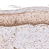 Anti-PARP14 antibody produced in rabbit Prestige Antibodies® Powered by Atlas Antibodies, affinity isolated antibody, buffered aqueous glycerol solution