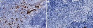 Anti-IDO1 Antibody, clone 1B17 ZooMAb® Rabbit Monoclonal recombinant, expressed in HEK 293 cells