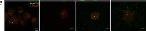 Anti-Tubulin Antibody, Detyrosinated Chemicon®, from rabbit