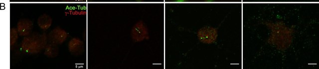 Anti-Tubulin Antibody, Detyrosinated Chemicon&#174;, from rabbit