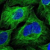 Anti-ZDHHC18 antibody produced in rabbit Prestige Antibodies® Powered by Atlas Antibodies, affinity isolated antibody, buffered aqueous glycerol solution