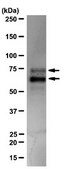 Anti-p70 S6 Kinase Antibody, clone 20-10C-6, rabbit monoclonal clone 20-10C-6, from rabbit, unconjugated