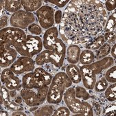 Anti-RNF114 antibody produced in rabbit Prestige Antibodies® Powered by Atlas Antibodies, affinity isolated antibody, buffered aqueous glycerol solution