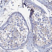 Anti-STRA6 antibody produced in rabbit Prestige Antibodies® Powered by Atlas Antibodies, affinity isolated antibody, buffered aqueous glycerol solution