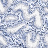 Anti-HOOK1 antibody produced in rabbit Prestige Antibodies® Powered by Atlas Antibodies, affinity isolated antibody, buffered aqueous glycerol solution, Ab1