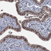 Anti-RASSF4 antibody produced in rabbit Prestige Antibodies® Powered by Atlas Antibodies, affinity isolated antibody, buffered aqueous glycerol solution