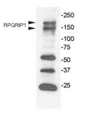 Anti-RPGRIP1 from rabbit