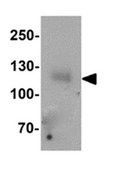Anti-LEMD3 Antibody from rabbit, purified by affinity chromatography