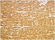 Anti-Tirap Antibody from rabbit, purified by affinity chromatography