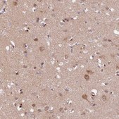 Anti-SAMD4A antibody produced in rabbit Prestige Antibodies® Powered by Atlas Antibodies, affinity isolated antibody, buffered aqueous glycerol solution