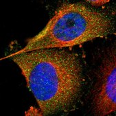 Anti-FER antibody produced in rabbit affinity isolated antibody, buffered aqueous glycerol solution