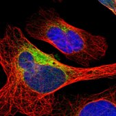 Anti-DNAJB11 antibody produced in rabbit Ab1, Prestige Antibodies® Powered by Atlas Antibodies, affinity isolated antibody, buffered aqueous glycerol solution