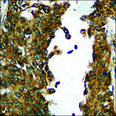 Anti-phospho-AXL (pTyr698) antibody produced in rabbit affinity isolated antibody