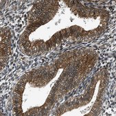 Anti-FAM134C antibody produced in rabbit Prestige Antibodies® Powered by Atlas Antibodies, affinity isolated antibody, buffered aqueous glycerol solution