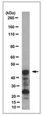 Anti-CLN3 Antibody, Clone 2B8.2 clone 2B8.2, from mouse