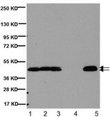 Anti-CNPase Antibody, clone 11-5B clone 11-5B, Chemicon®, from mouse
