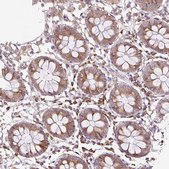 Anti-RPS23 antibody produced in rabbit Prestige Antibodies® Powered by Atlas Antibodies, affinity isolated antibody, buffered aqueous glycerol solution