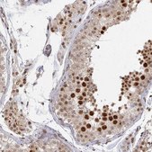 Anti-PSKH1 antibody produced in rabbit Prestige Antibodies® Powered by Atlas Antibodies, affinity isolated antibody, buffered aqueous glycerol solution