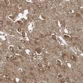 Anti-COX10 antibody produced in rabbit Prestige Antibodies® Powered by Atlas Antibodies, affinity isolated antibody, buffered aqueous glycerol solution