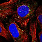 Anti-NSUN7 antibody produced in rabbit Prestige Antibodies® Powered by Atlas Antibodies, affinity isolated antibody, buffered aqueous glycerol solution