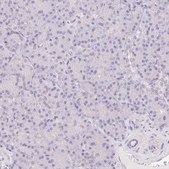 Anti-CTNND2 antibody produced in rabbit Prestige Antibodies® Powered by Atlas Antibodies, affinity isolated antibody, buffered aqueous glycerol solution