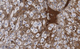 Anti-ITIH1 Antibody, clone 1K16 ZooMAb® Rabbit Monoclonal recombinant, expressed in HEK 293 cells
