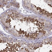 Anti-ELOVL5 antibody produced in rabbit Prestige Antibodies® Powered by Atlas Antibodies, affinity isolated antibody, buffered aqueous glycerol solution