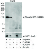 Rabbit anti-Phospho KAP-1 (S824) Antibody, Affinity Purified Powered by Bethyl Laboratories, Inc.