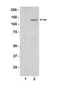 Anti-phospho-JAK2 (Tyr1007/1008) Antibody Upstate®, from rabbit