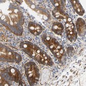 Anti-RAPH1 antibody produced in rabbit Prestige Antibodies® Powered by Atlas Antibodies, affinity isolated antibody, buffered aqueous glycerol solution