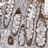 Anti-KIF15 antibody produced in rabbit Prestige Antibodies® Powered by Atlas Antibodies, affinity isolated antibody, buffered aqueous glycerol solution