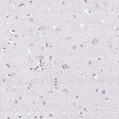 Anti-HK3 antibody produced in rabbit Prestige Antibodies® Powered by Atlas Antibodies, affinity isolated antibody, buffered aqueous glycerol solution
