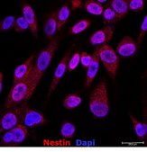 Dipg Color Human DIPG Cell Line Glioma Therapeutic Screening Millipore