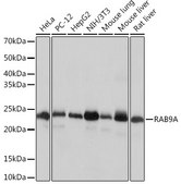 Anti-RAB9A Antibody, clone 7O1G4, Rabbit Monoclonal