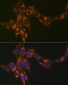 Anti-ACADM antibody produced in rabbit