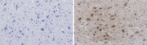 Anti-Choline Acetyltransferase (ChAT) Antibody, clone 2K16, ZooMAb® Rabbit Monoclonal recombinant, expressed in HEK 293 cells