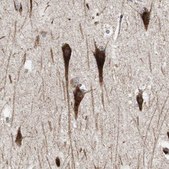 Anti-SORT1 antibody produced in rabbit Prestige Antibodies® Powered by Atlas Antibodies, affinity isolated antibody, buffered aqueous glycerol solution