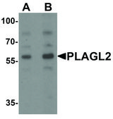 Anti-PLAGL2 antibody produced in rabbit affinity isolated antibody, buffered aqueous solution