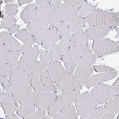 Anti-CDKN2B antibody produced in rabbit Prestige Antibodies® Powered by Atlas Antibodies, affinity isolated antibody, buffered aqueous glycerol solution